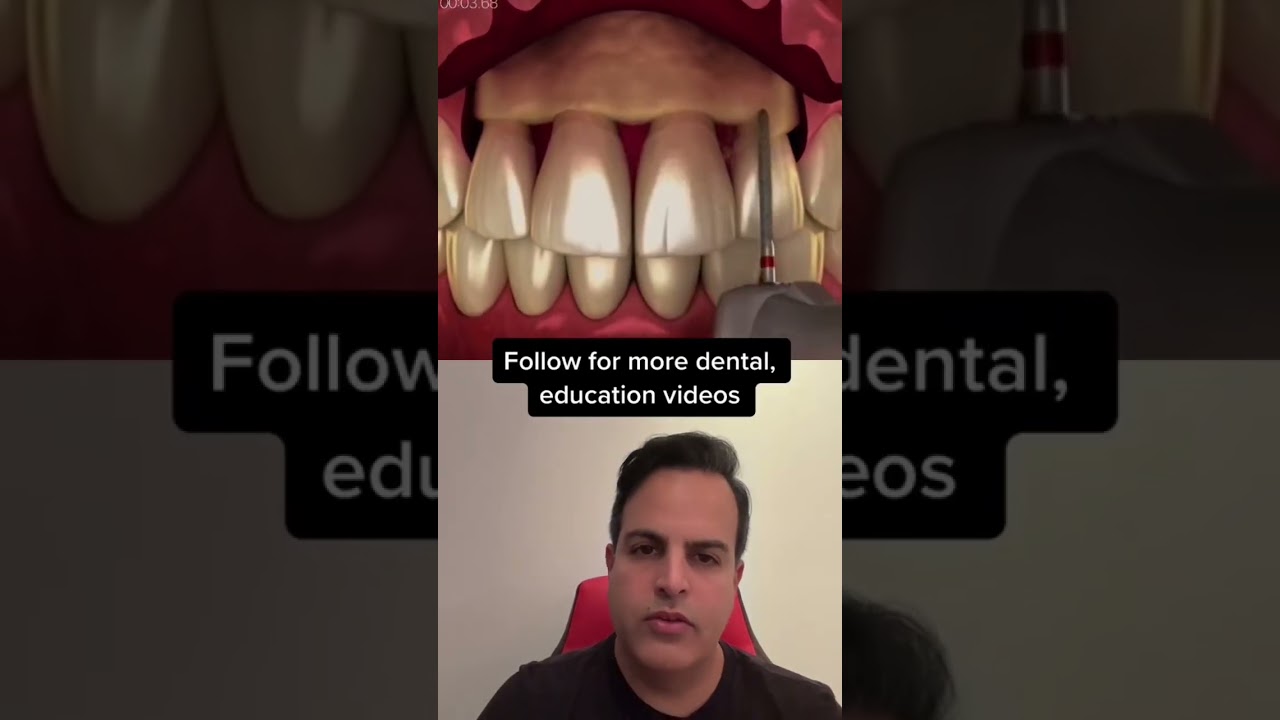 Shaving the jawbone for this🤯!