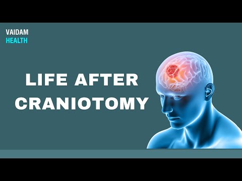 Video: Zašto se radi kraniotomija?