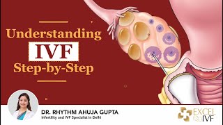 Understanding IVF Step-by-Step: Timeline, Procedure & What to Expect | Dr Rhythm Gupta - Excel IVF