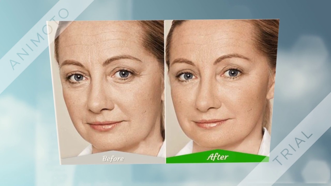 best treatment for eye wrinkles YouTube