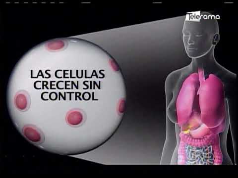 650 casos de cáncer de piel se registran al año en Ecuador