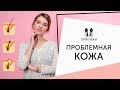 Всё об уходе за ПРОБЛЕМНОЙ КОЖЕЙ: косметолог отвечает на вопросы [Шпильки | Женский журнал]