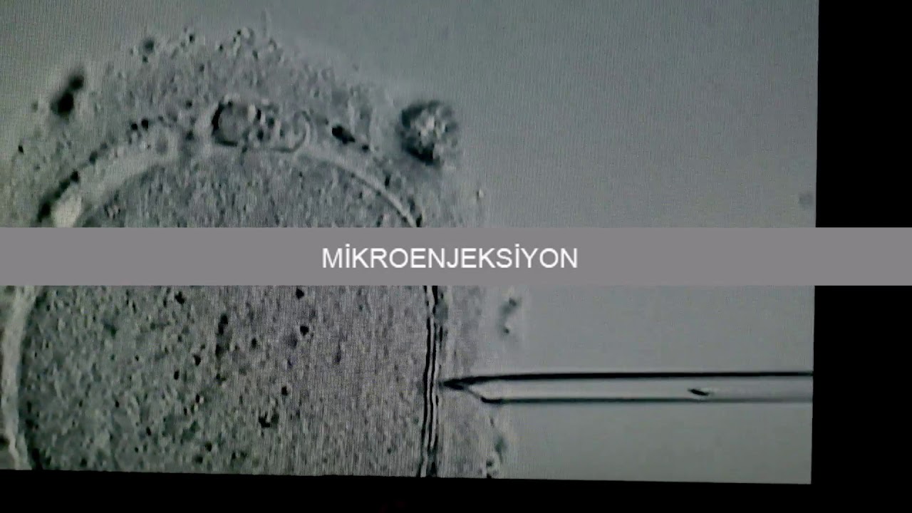 Tüp Bebek Yolculuğu YouTube