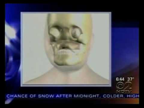 Misc & International Videos