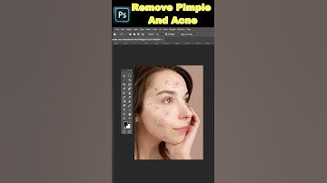 Remove Pimples and Acne | Photoshop Tutorials | #shorts #viral #adobephoto