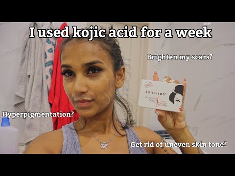 I Used Kojic Acid For A Week & This Happened || Kojie San Review