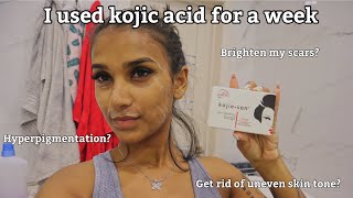 I Used Kojic Acid For A Week & This Happened || Kojie San Review