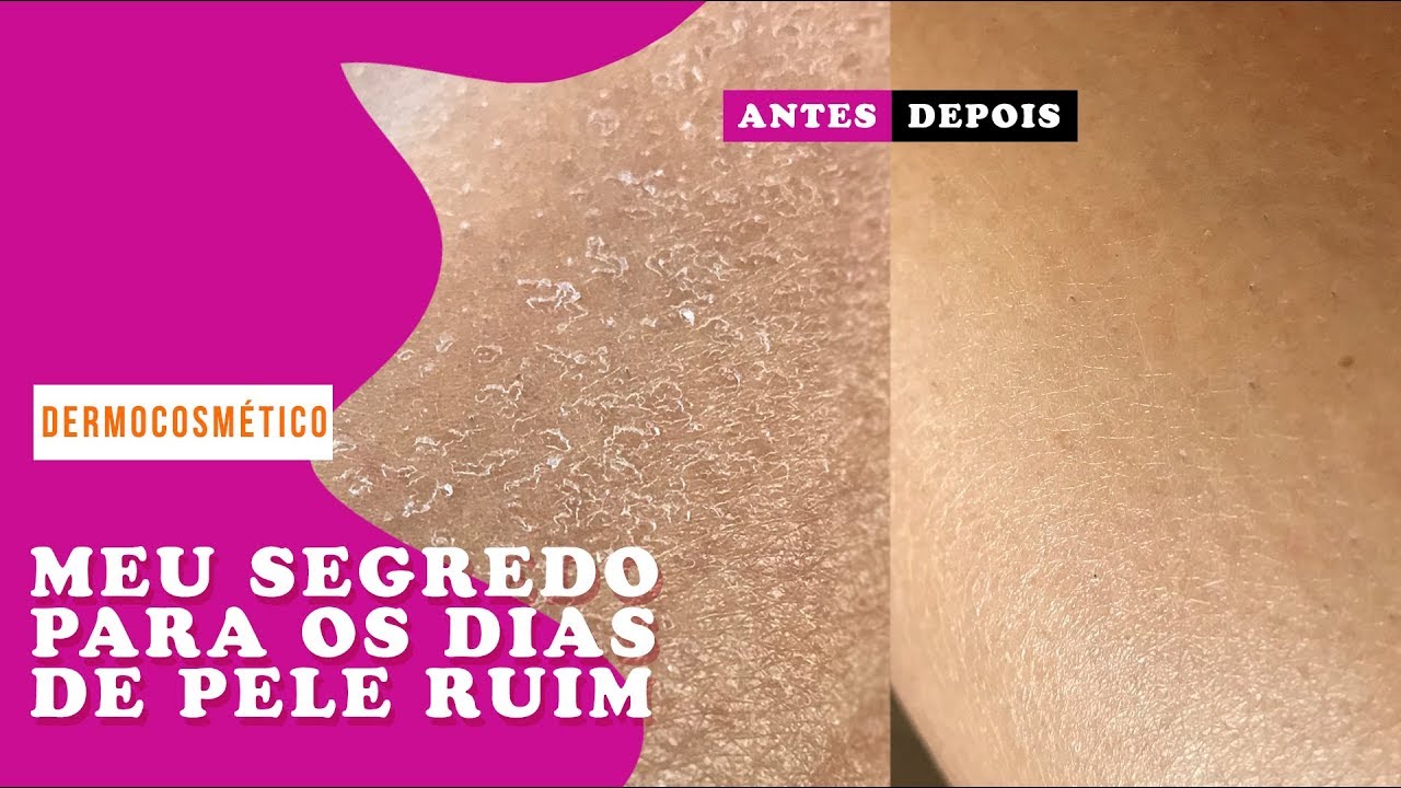 DÊ UM UP NA SUA PELE EM 5 MINUTOS