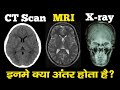 Difference Between MRI CT Scan And X-ray in Hindi | MRI Scan Kaise Hota hai?