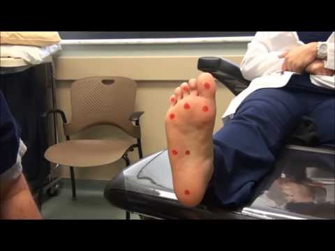 Neurologic Examination of the Foot: 10gm Monofilament Test