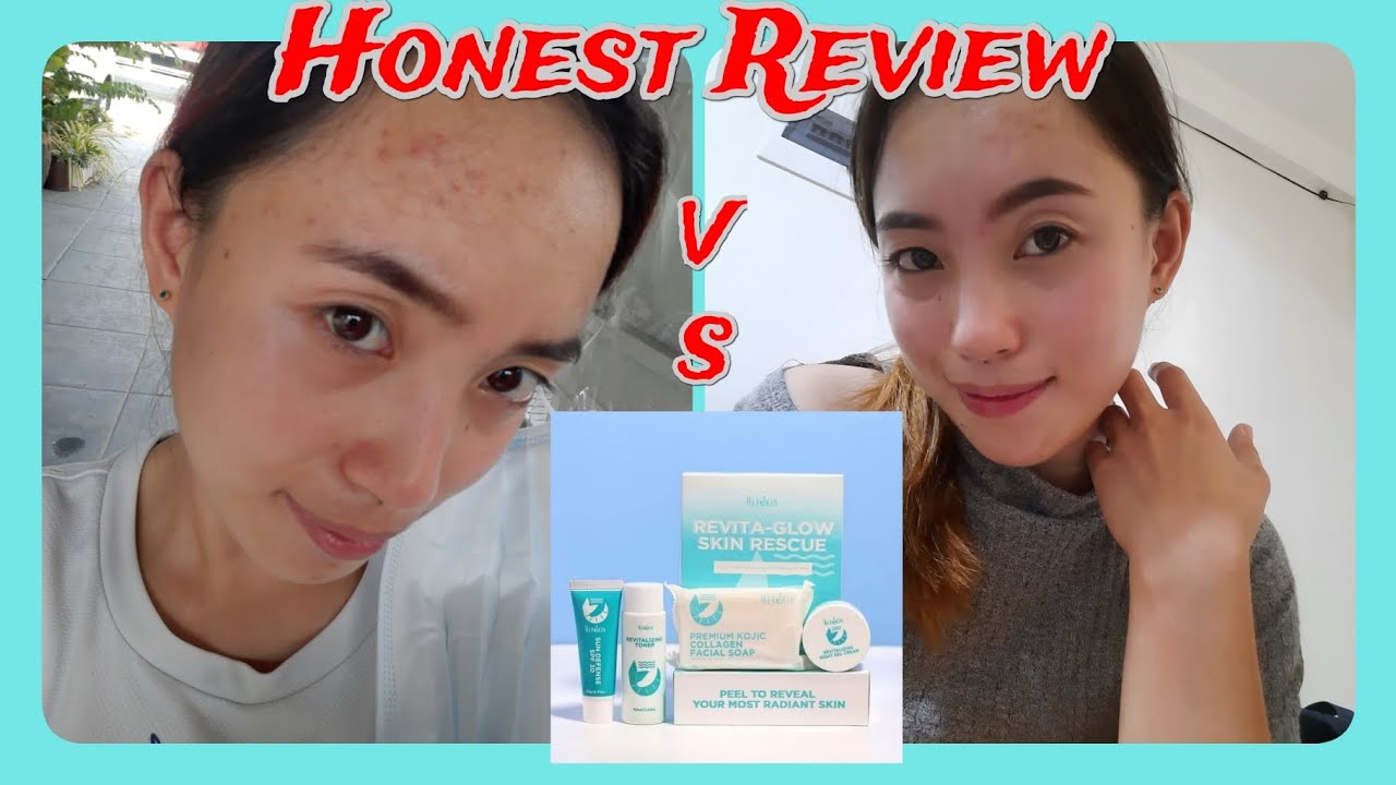 HERSKIN Revita-Glow Skin Rescue by Kath Melendez | My Honest Review