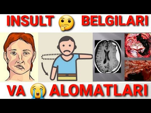 Video: Misoginist. Belgilar. Kelib Chiqishi