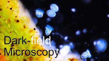 Dark-field Microscopy