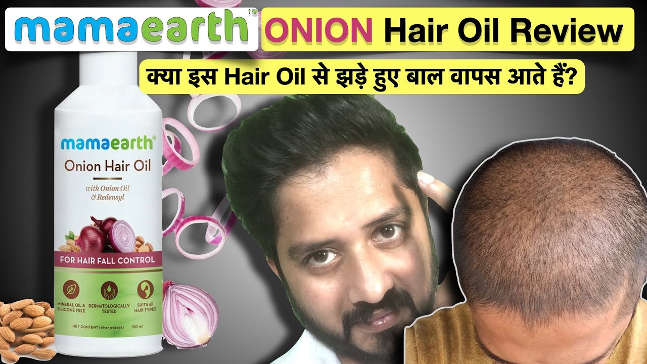 Mamaearth Onion Hair Oil Review. Onion Hair Oil for Hair Regrowth. - YouTube