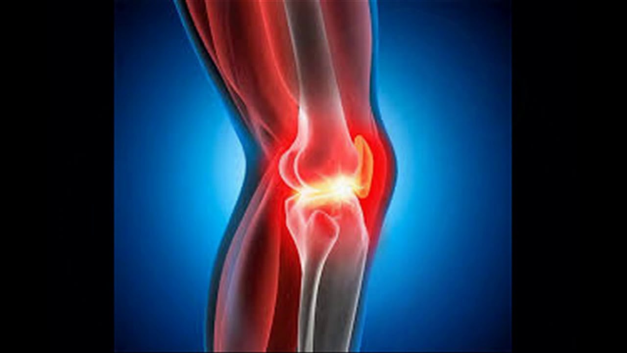 Arthritis 1 Healing Rife - YouTube