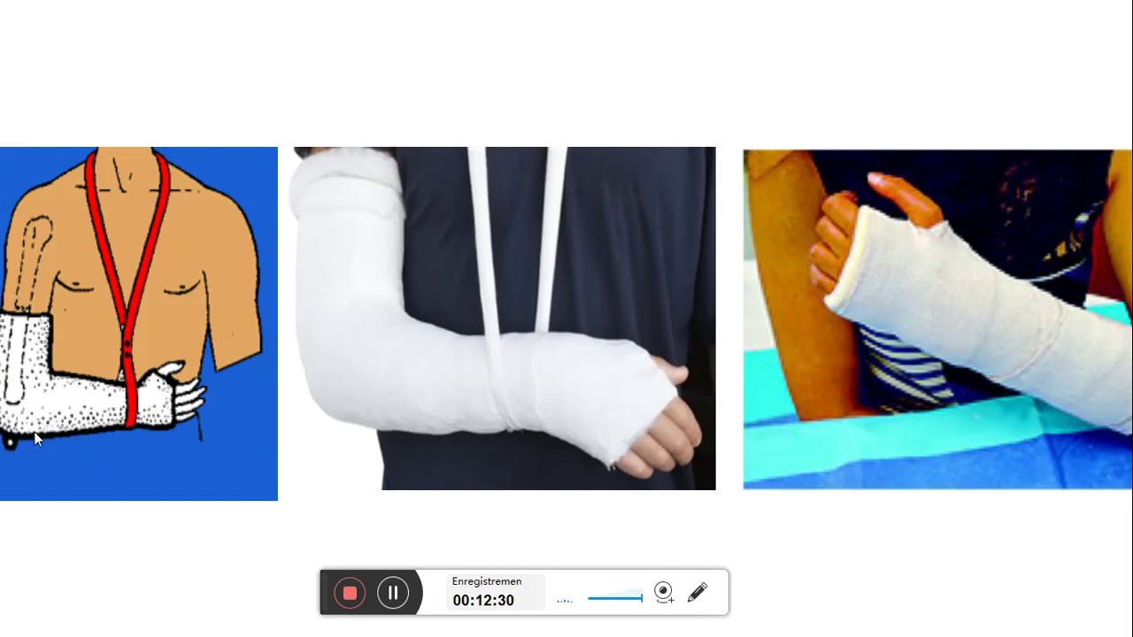 TD contentions en traumatologie