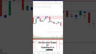 How I Avoided Today's Expiry Trap (Live Setup) 📊 #shorts #trading