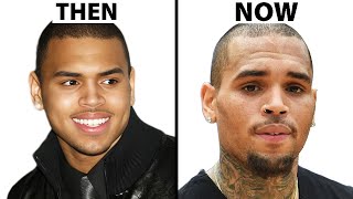 Did Chris Brown Have Plastic Surgery? | Plastic Surgery Analysis
