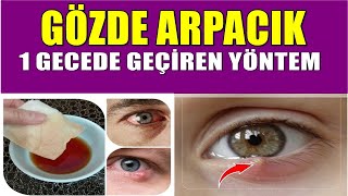 Gözünüzdeki Arpacığı 1 Gecede Bitiriyor ! 10 DAKİKA UYGULAMANIZ YETERLİ