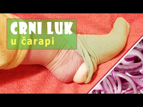 CRNI LUK kao lek u čarapama