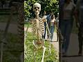 When Your Hand Resigns in Public! 😱🦴 #Funny#shorts #youtubeshorts #funny #skeleton #trending