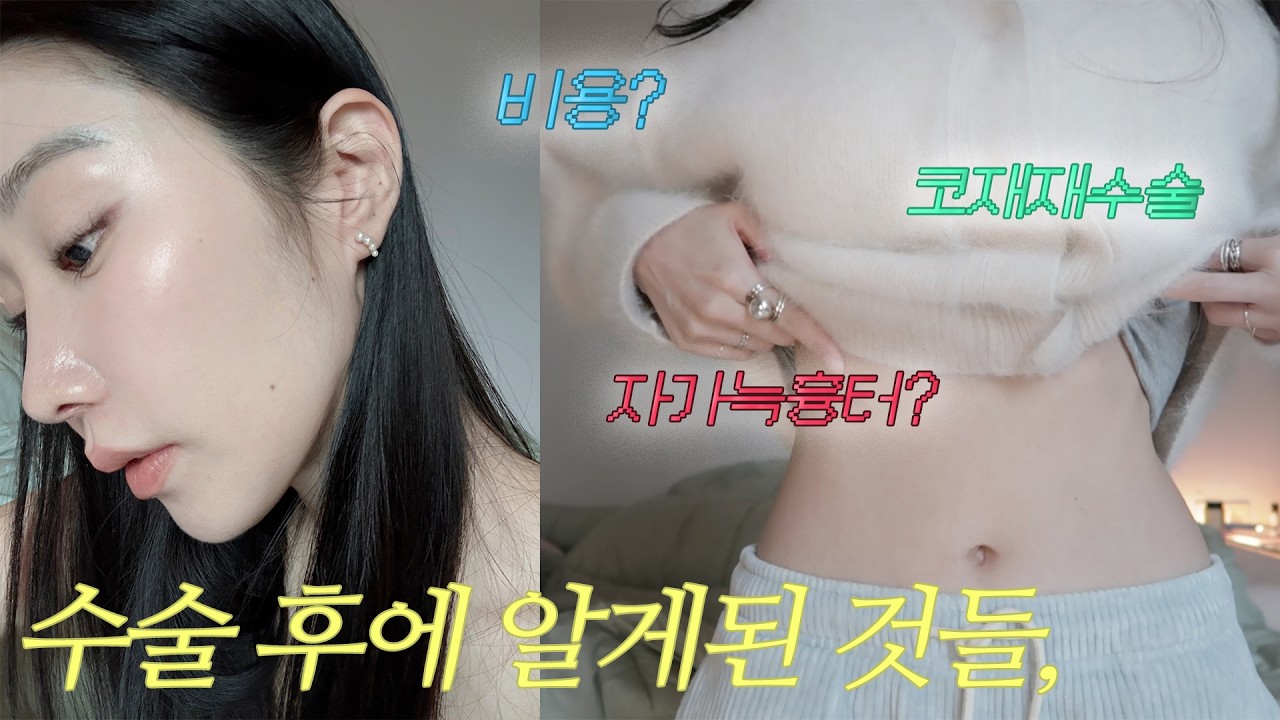 코재재수술 4개월차가 되어서야 할 수 있는 이야기