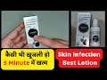     5 minute    skin infection best lotion  drx vivek health and beauty