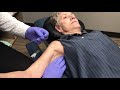 Treating Frozen Shoulder With Dry Needling