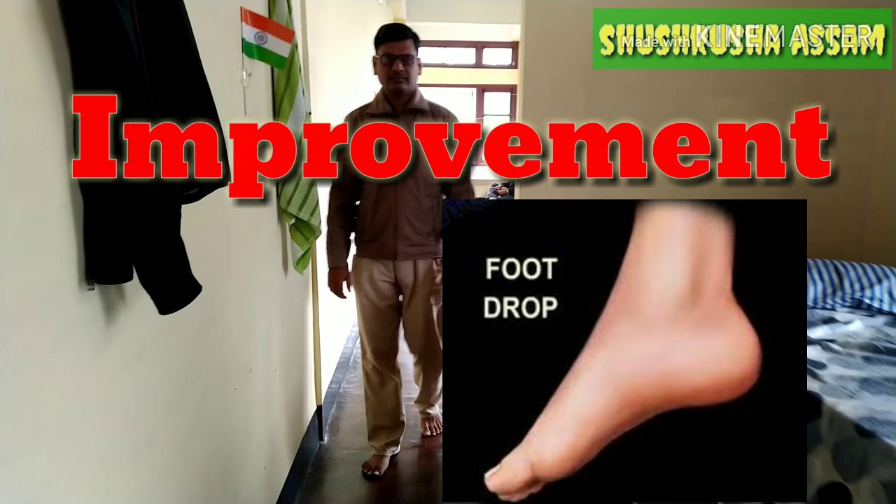 Improvement Foot Drop YouTube improvement-foot-drop-youtube
