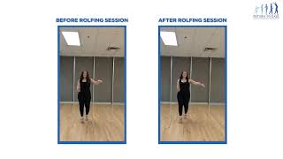 Rolfing® Before & After for a Salsa Dancer – One Session Transformation