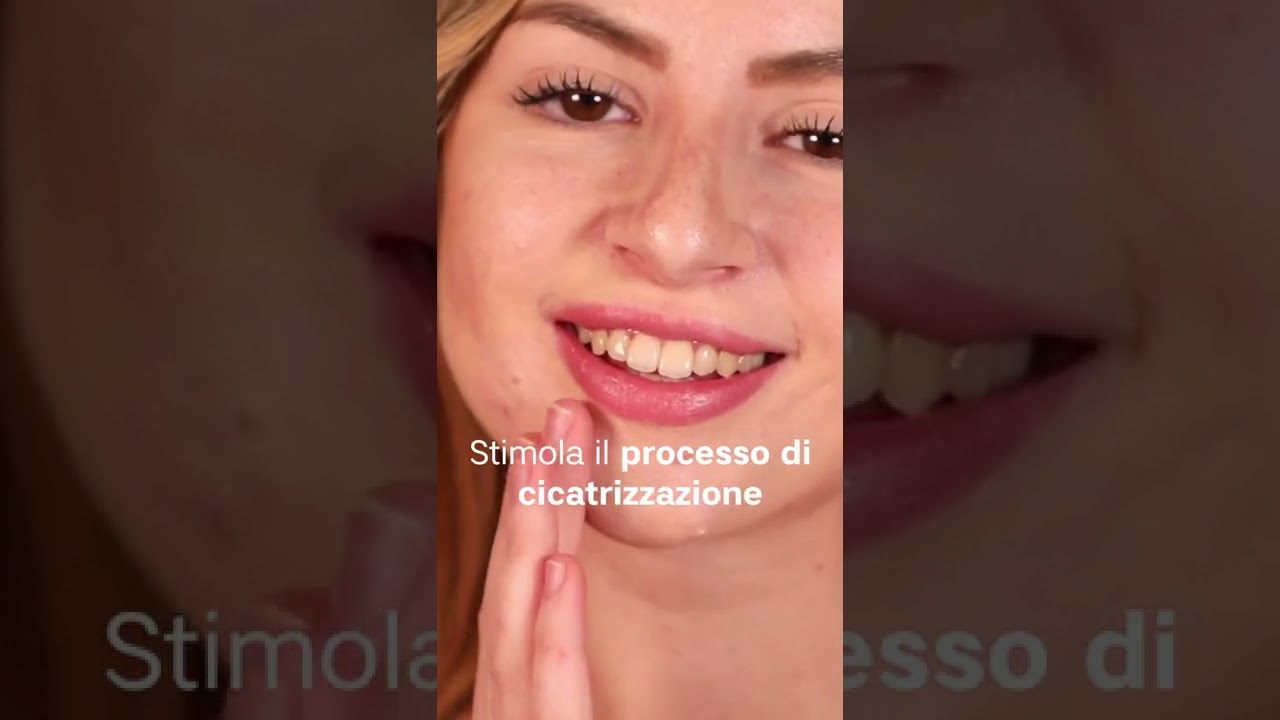 Dì addio a brufoli e segni dell'acne grazie a Brufostop