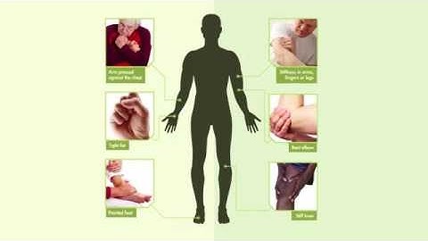 Spasticity Informational Video