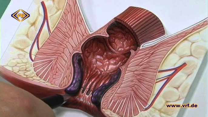 Proktologning videosi bor Proktologning videosi bor