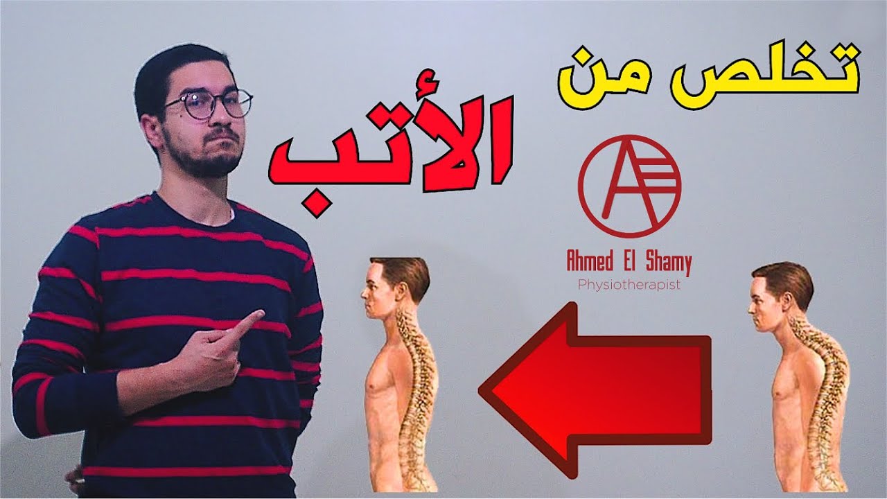 أفضل تمارين للتخلص من الأتب | تقوس العمود الفقري - Kyphosis - YouTube