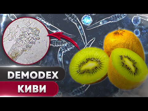 🥝 Киви против клеща | Угревая Железница Demodex