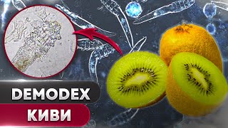 🥝 Киви против клеща | Угревая Железница Demodex