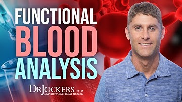 Functional Blood Analysis and Optimal Ranges