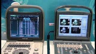 ECO1 VS A6 v20150303