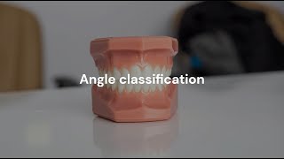 ANGLE CLASSIFICATION