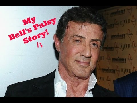 My Bell's Palsy Story - YouTube