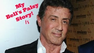 My Bell's Palsy Story