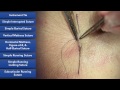 Learn how to suture  best suture techniques and training