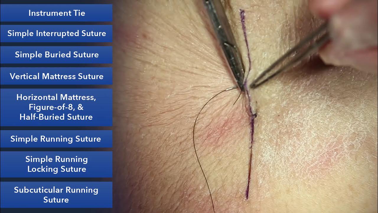 damp At forurene Fodgænger Learn How To Suture - Best Suture Techniques and Training - YouTube