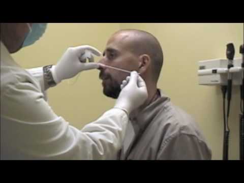 Procedure for Nasopharyngeal Swabs and Aspirates - YouTube