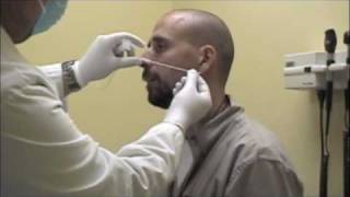 Procedure For Nasopharyngeal Swabs And Aspirates