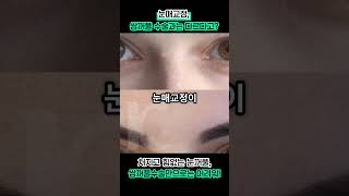 [광주 케이스타의원] #눈매교정, #쌍꺼풀수술과 비슷하다고 생각했다면 오산!