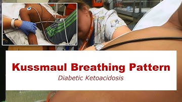 Kussmaul Breathing Pattern