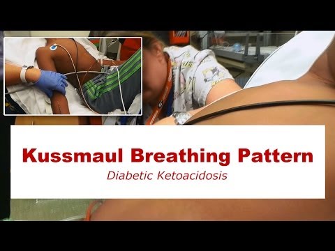 Видео: Kussmaul дыхание: причины и симптомы дыхания Kussmaul
