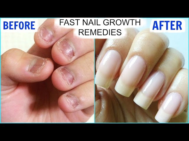 Exploring Nail Growth 101: How to Make Your Nails Grow Faster and Stronger