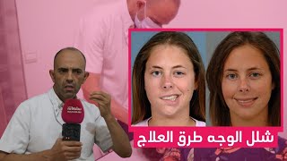 الشلل النصفي للوجه.. كيف يتم علاجه؟ ماهي الطرق؟ نصائح الاختصاصي في العلاج الطبيعي مصطفى بلعباس